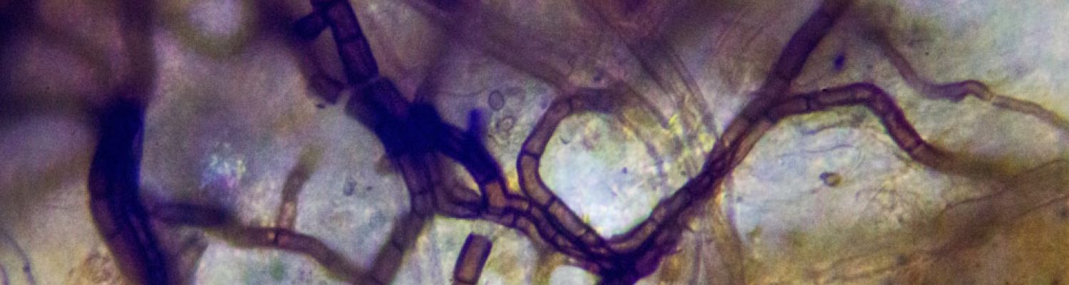 mycellium_through_microscope_9118-adj_web